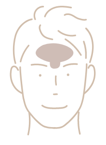 おでこ（眉間含む）