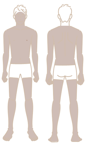 全身脱毛（VIO除く）