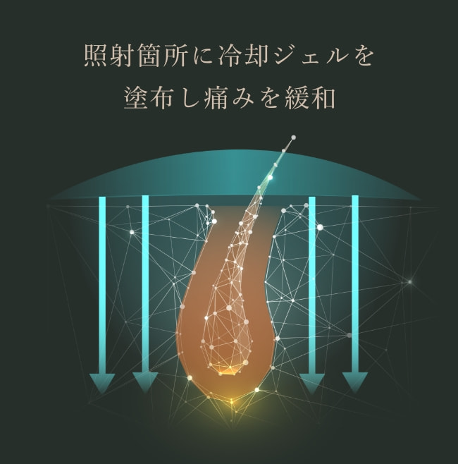 照射箇所に冷却ジェルを塗布し痛みを緩和